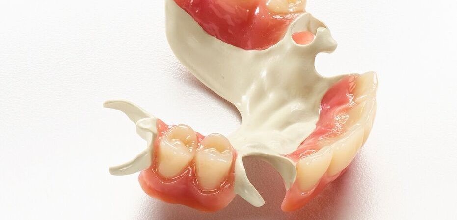 Types Of Partial Dentures Dillwyn VA 23936